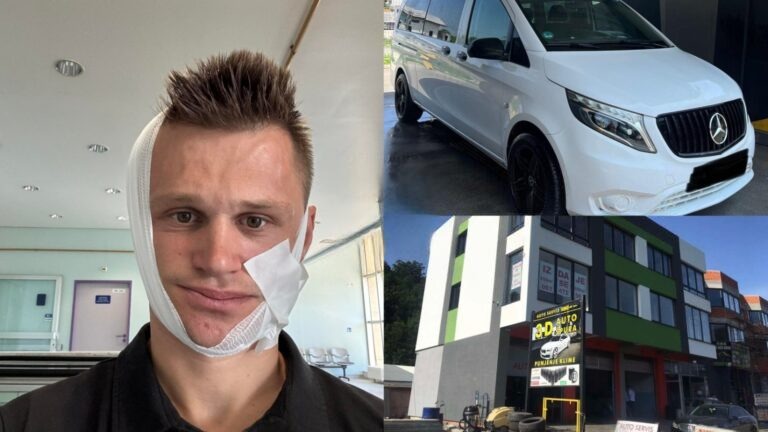 Brutalan napad u Binježevu: Ammaru slomljena vilica na oba dijela nakon sukoba u automehaničarskoj radionici